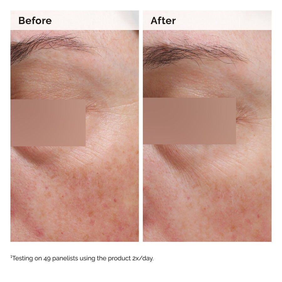 niacinamide-5-face-and-body-emulsion-q4 2024-08-23-ORD-Nia-5pct-Face-Body-B-A-Elasticity-Global-02-1x1.jpg