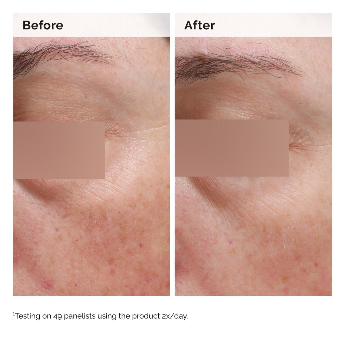 niacinamide-5-face-and-body-emulsion-q4 2024-08-23-ORD-Nia-5pct-Face-Body-B-A-Elasticity-Global-02-1x1.jpg