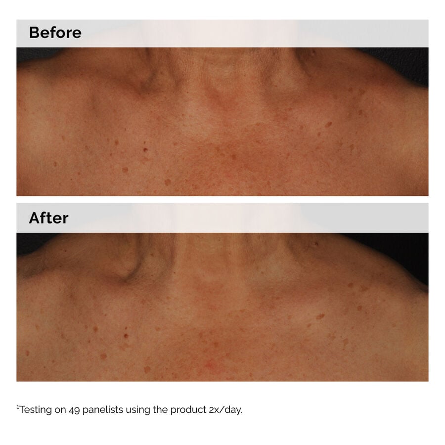 niacinamide-5-face-and-body-emulsion-q4 2024-08-23-ORD-Nia-5pct-Face-Body-B-A-Global-02-1x1.jpg