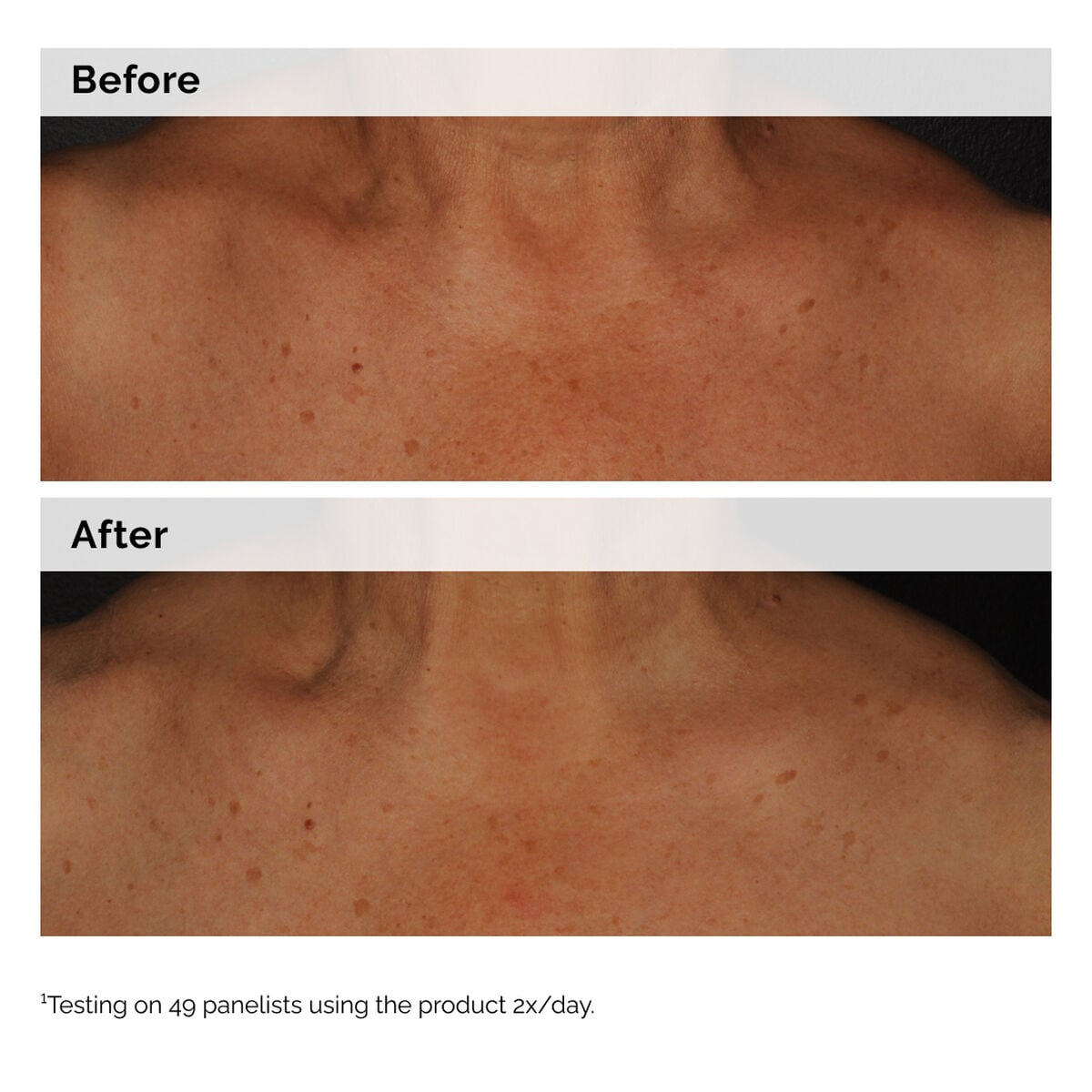 niacinamide-5-face-and-body-emulsion-q4 2024-08-23-ORD-Nia-5pct-Face-Body-B-A-Global-02-1x1.jpg