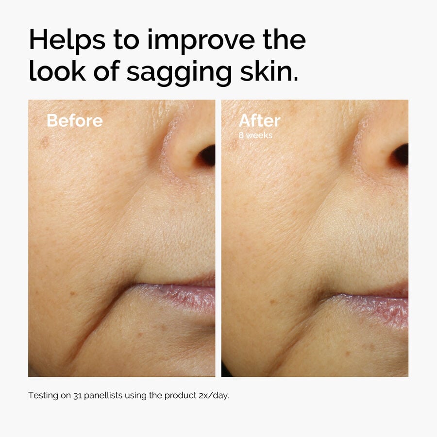 caffeine-3-escin-1-face-serum-a4 ord-caffeine-3pct-escin-1pct-face-serum-before-after-sagging.jpg