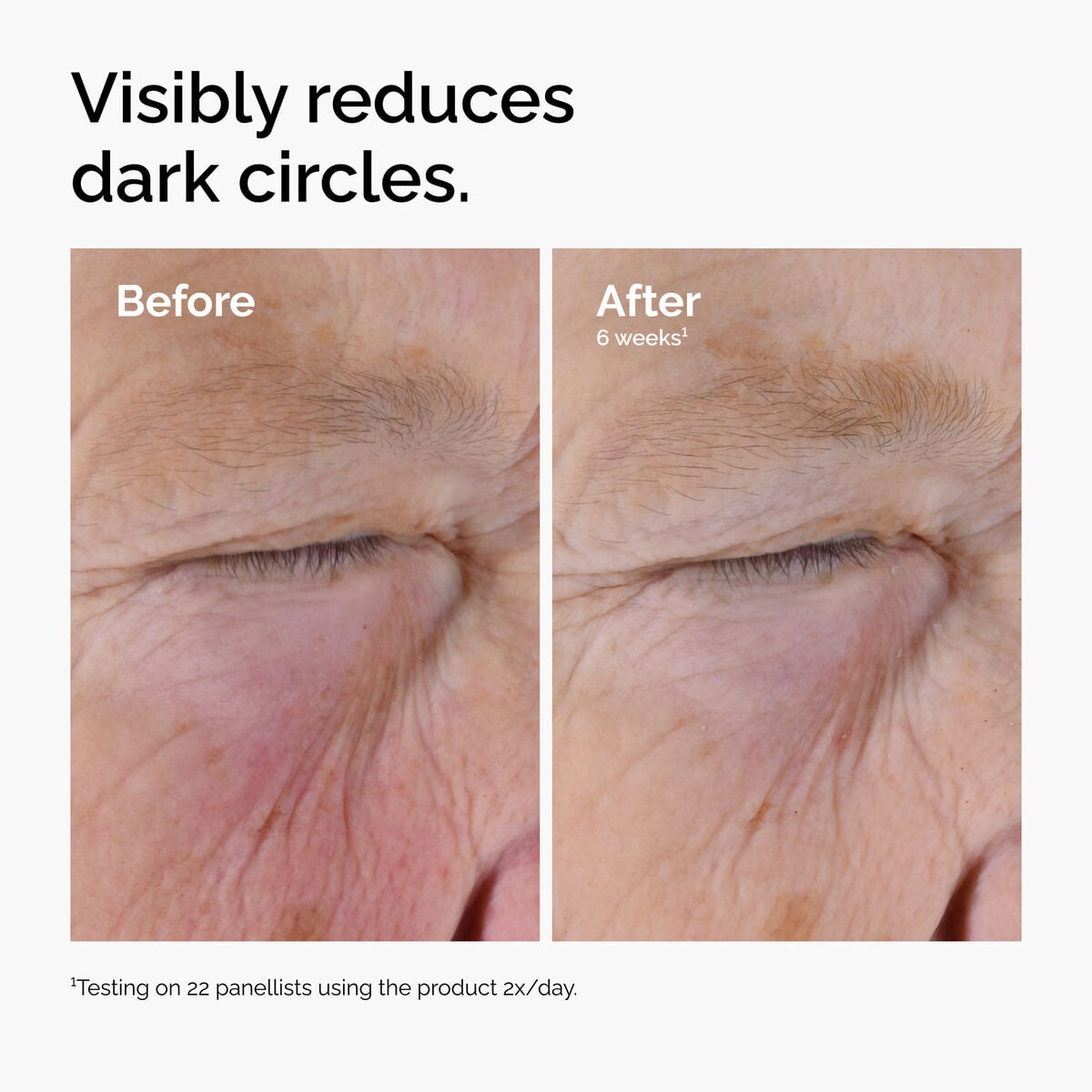 caffeine-solution-5-egcg-eye-serum-n7 ord-caffeine-solution-egcg-dark-circles-before-after.jpg