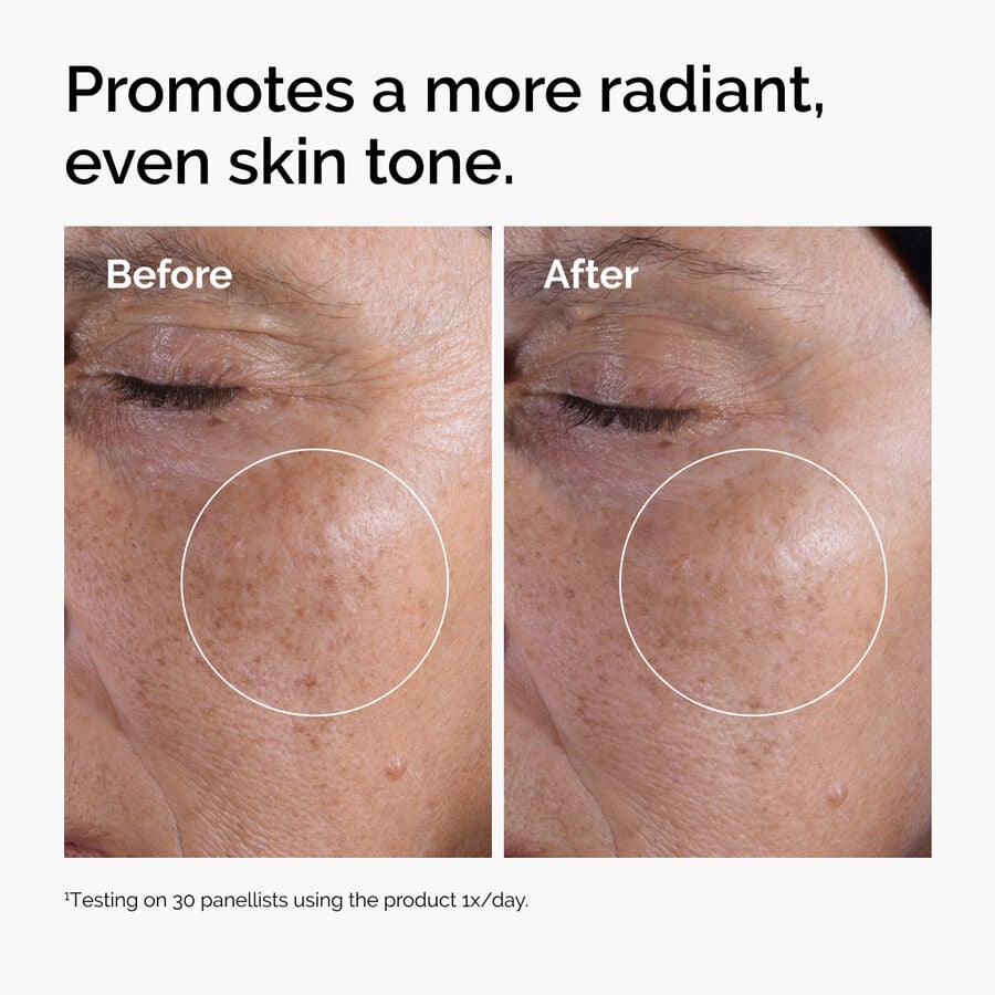 glycolic-acid-7-exfoliating-toner-n0 ord-glycolic-before-after-radiance.jpg