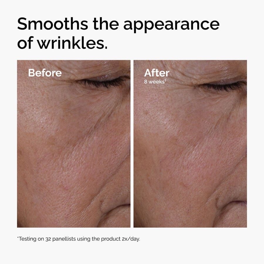 multi-peptide-ha-serum-z2 ord-multi-peptide-ha-serum-wrinkles-before-after.jpg