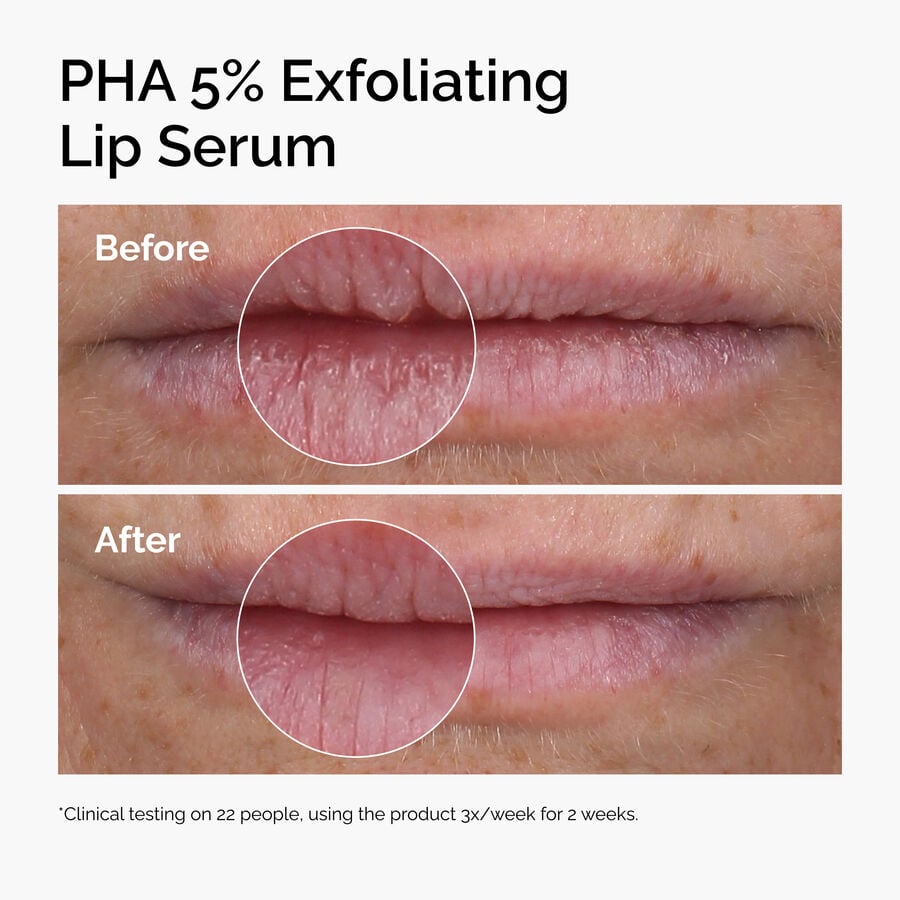 pha-5-exfoliating-lip-serum-h7 ord-pha-5pct-lip-exfoliating-serum-before-after.jpg