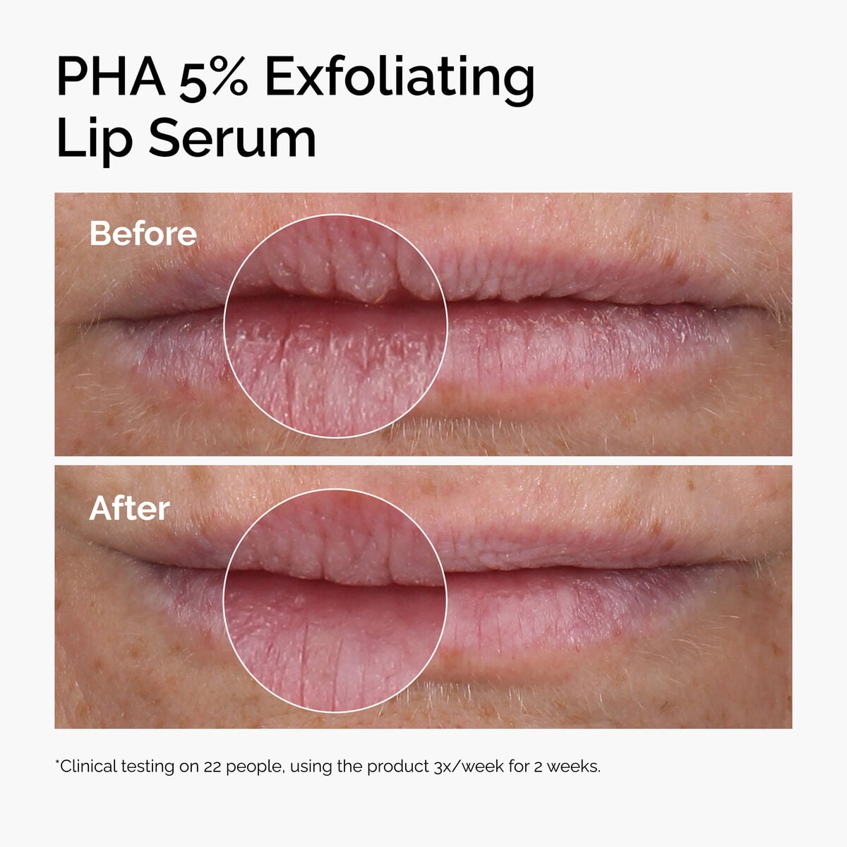 pha-5-exfoliating-lip-serum-h7 ord-pha-5pct-lip-exfoliating-serum-before-after.jpg